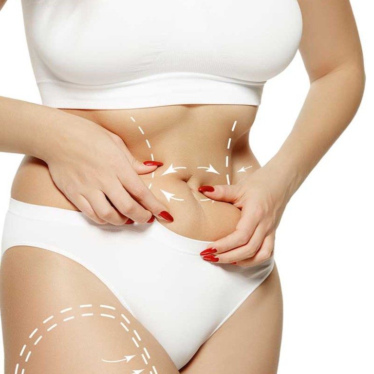 liposuction