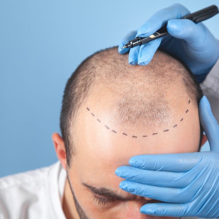 testhair