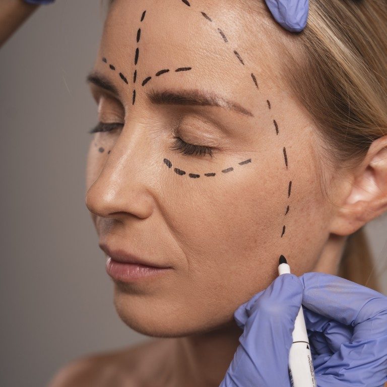 woman-preparing-cosmetic-surgery
